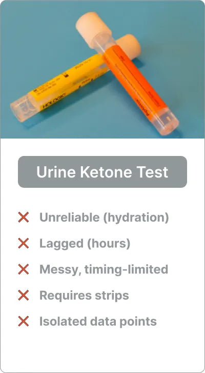 Urine Ketone Test