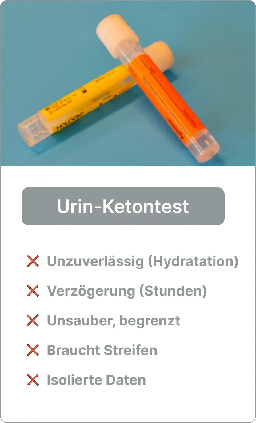 Urin-Keton-Test