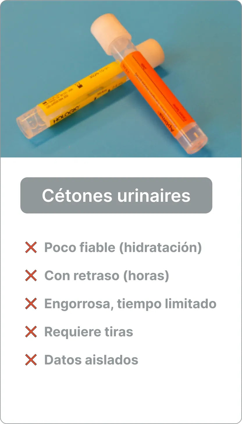 Prueba de cetonas en orina