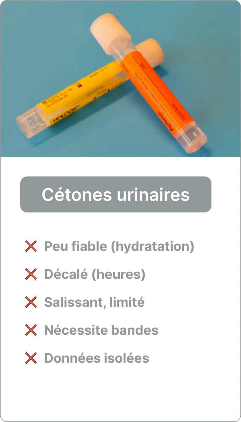 Test de cétone dans l'urine