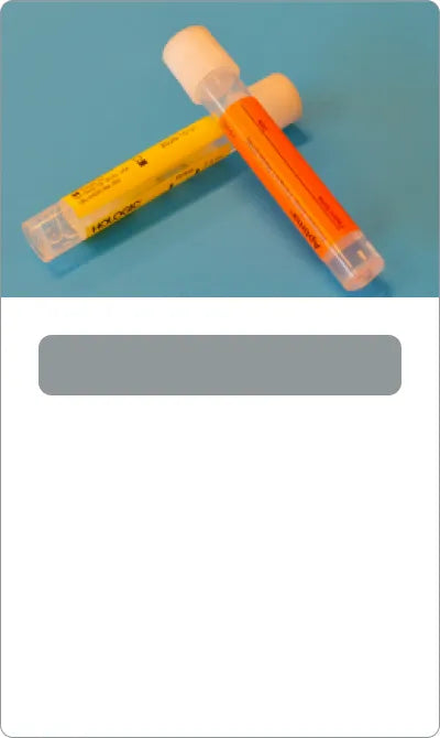 Urine Ketone Test