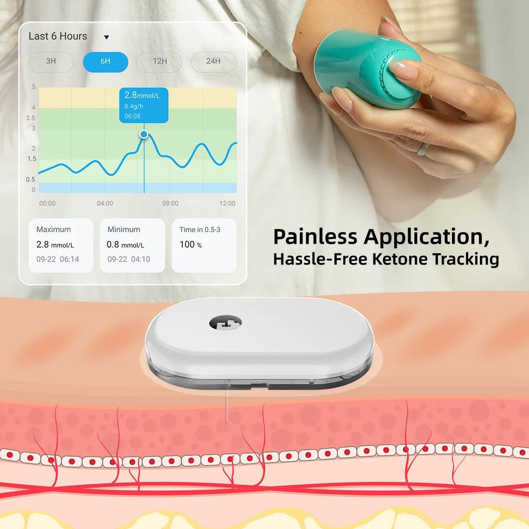 [ Special Bulk Purchase]SiBio KS1 Continuous Ketone Monitoring System (CKM) - SiBio